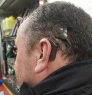 Mit einem Cochlear-Implantat kann ein Feuerwehrangehöriger wieder am Feuerwehrdienst teilnehmen. (Bild: Dirk Rixen /HFUK Nord)